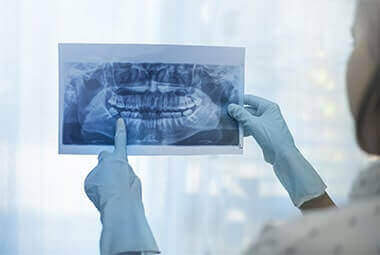 Jaw Surgery - Birmingham Orthodontics Sutton Coldfield